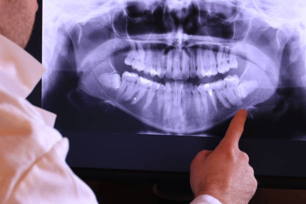 Best Broken or Chipped Tooth Repair in Post, TX